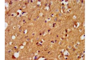 IHC image of ABIN7145227 diluted at 1:400 and staining in paraffin-embedded human brain tissue performed on a Leica BondTM system. (BAIAP3 Antikörper  (AA 131-257))