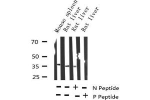 Western blot analysis of Phospho-I kappaB epsilon (Ser22) expression in various lysates (NFKBIE Antikörper  (pSer161))