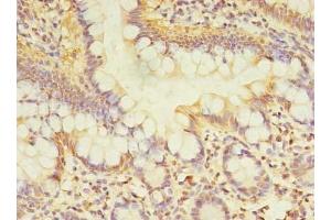 Immunohistochemistry of paraffin-embedded human small intestine tissue using ABIN7171449 at dilution of 1:100 (TCP11L2 Antikörper  (AA 1-210))