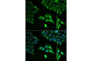 Immunofluorescence analysis of U2OS cells using ACADS antibody. (ACADS Antikörper)