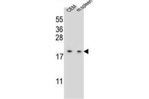 Western blot analysis of LSM7 Antibody (C-term) in CEM cell line and mouse spleen tissue lysates (35ug/lane). (LSM7 Antikörper  (C-Term))