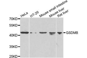 Western blot analysis of extracts of various cell lines, using GSDMB antibody. (Gasdermin B Antikörper)