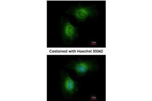 ICC/IF Image Immunofluorescence analysis of methanol-fixed HeLa, using Cytochrome P450 1B1, antibody at 1:200 dilution. (CYP1B1 Antikörper  (Center))
