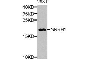 Western blot analysis of extracts of 293T cells, using GNRH2 antibody. (GnRH2 Antikörper)