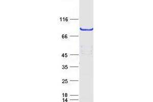 Validation with Western Blot (METTL13 Protein (Transcript Variant 1) (Myc-DYKDDDDK Tag))