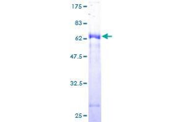 CA5B Protein (AA 1-317) (GST tag)