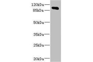 Western blot All lanes: MAP4K5 antibody at 4. (MAP4K5 Antikörper  (AA 300-480))