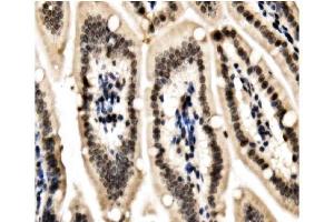IHC analysis of HP1 alpha/CBX5 using anti-HP1 alpha/CBX5 antibody (ABIN7599058). (CBX5 Antikörper  (AA 1-191))