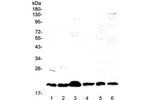 Western blot testing of 1) mouse stomach, 2) mouse spleen, 3) mouse thymus, 4) mouse small intestine, 5) rat thymus and 6) human placental lysate with ICOS antibody at 0. (ICOS Antikörper)