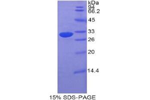 SDS-PAGE analysis of Mouse ETFa Protein. (Electron-Transfer-Flavoprotein, alpha Polypeptide (ETFA) Peptid)