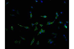 Immunofluorescence staining of MCF-7 cells with ABIN7159373 at 1:100, counter-stained with DAPI. (MBTPS1 Antikörper  (AA 187-400))