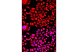 Immunofluorescence analysis of A549 cells using MTHFD1L antibody. (MTHFD1L Antikörper  (AA 759-978))