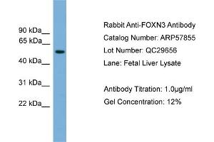 WB Suggested Anti-FOXN3  Antibody Titration: 0. (FOXN3 Antikörper  (Middle Region))
