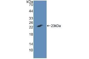 Detection of Recombinant CASP7, Human using Polyclonal Antibody to Caspase 7 (CASP7)