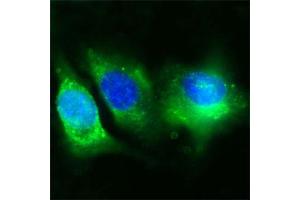 Image no. 4 for anti-CD36 (CD36) (Extracellular Domain) antibody (ABIN350201)