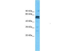 Host:  Rabbit  Target Name:  MLLT3  Sample Type:  721_B Cell lysates  Antibody Dilution:  1. (AF9 Antikörper  (N-Term))