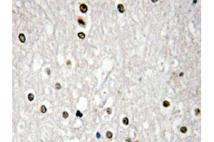 Immunohistochemical analysis of paraffin-embedded human brain tissue using TP73 polyclonal antibody . (Tumor Protein p73 Antikörper)