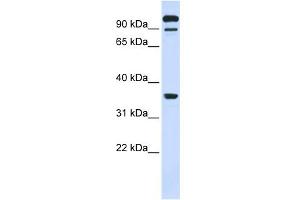 WB Suggested Anti-PTPRE Antibody Titration:  0. (PTPRE Antikörper  (Middle Region))