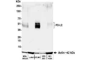 Western Blotting (WB) image for anti-Programmed Cell Death 1 Ligand 2 (PDCD1LG2) (AA 20-220) antibody (ABIN7795675)