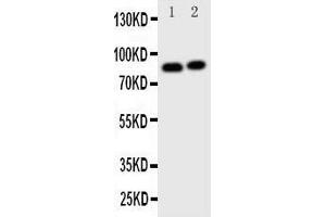 Western Blotting (WB) image for anti-Gelsolin (GSN) (AA 763-775), (C-Term) antibody (ABIN3043978) (Gelsolin Antikörper  (C-Term))