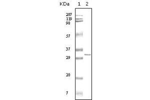 Western blot analysis using HPTR mouse mAb against truncated HPRT recombinant protein. (HPRT1 Antikörper)