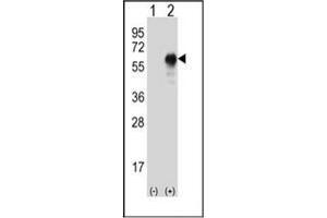 Western blot analysis of LZP (arrow) using LZP Antibody . (OIT3 Antikörper)