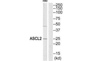 Western Blotting (WB) image for anti-Achaete-Scute Complex Homolog 2 (ASCL2) (Internal Region) antibody (ABIN1849922) (ASCL2 Antikörper  (Internal Region))