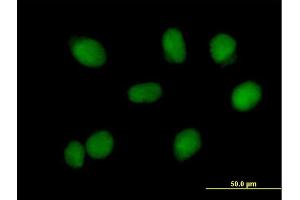 Immunofluorescence of purified MaxPab antibody to RMI1 on HeLa cell. (RMI1 Antikörper  (AA 1-470))
