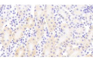 Detection of PCDHb2 in Mouse Kidney Tissue using Polyclonal Antibody to Protocadherin Beta 2 (PCDHb2) (PCDHb2 Antikörper  (AA 79-253))