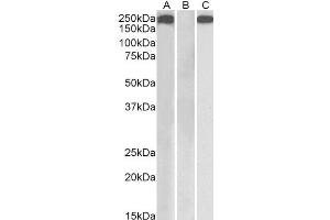 HEK293 lysate (10ug protein in RIPA buffer) overexpressing Human THBS1 with C-terminal MYC tag probed with ABIN1781804 (1ug/ml) in Lane A and probed with anti-MYC Tag (1/1000) in lane C.