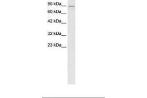 Image no. 2 for anti-Kinesin Family Member 5B (KIF5B) (AA 694-743) antibody (ABIN6736277)