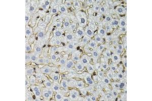 Immunohistochemistry of paraffin-embedded mouse liver using ANXA2 antibody. (Annexin A2 Antikörper)
