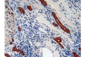 IHC-P analysis of Human Liver Tissue, with DAB staining. (Cytokeratin 7 Antikörper  (AA 91-394))