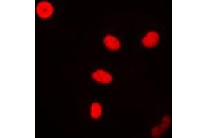 Immunofluorescent analysis of FEN1 staining in MCF7 cells. (FEN1 Antikörper  (Center))