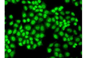 Immunofluorescence analysis of HeLa cells using GTF2F1 antibody.