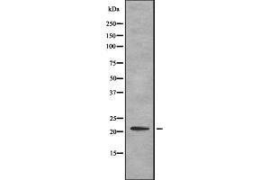 Western blot analysis of ITBP1 expression in HEK293 cells ,The lane on the left is treated with the antigen-specific peptide. (ITGB1BP1 Antikörper  (Internal Region))