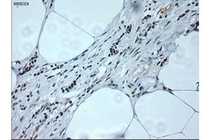 Immunohistochemical staining of paraffin-embedded liver tissue using anti-NEUROG1mouse monoclonal antibody. (Neurogenin 1 Antikörper)