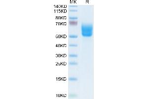Biotinylated Human DKK3 on Tris-Bis PAGE under reduced conditions. (DKK3 Protein (AA 23-350) (His-Avi Tag,Biotin))