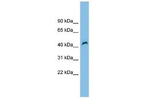 PNPLA1 antibody used at 1 ug/ml to detect target protein. (PNPLA1 Antikörper  (Middle Region))