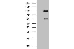 Western Blotting (WB) image for anti-ADAM Metallopeptidase with Thrombospondin Type 1 Motif, 4 (ADAMTS4) (AA 296-577) antibody (ABIN2715720) (ADAMTS4 Antikörper  (AA 296-577))