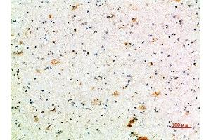 Immunohistochemistry (IHC) image for anti-Fc Fragment of IgG, High Affinity Ia, Receptor (CD64) (FCGR1A) (AA 230-280) antibody (ABIN7189472)