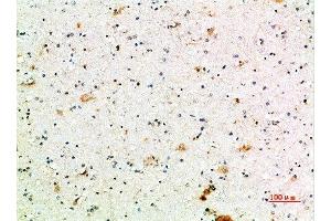 Immunohistochemical analysis of paraffin-embedded human-brain, antibody was diluted at 1:200 (FCGR1A Antikörper  (AA 230-280))