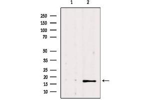 Western blot analysis of extracts from 293, using NME1 Antibody.