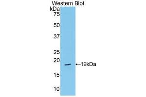 Western blot analysis of the recombinant protein. (Periostin Antikörper  (AA 659-810))