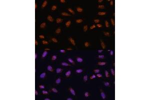 Immunofluorescence analysis of U-2 OS cells using SARNP antibody (ABIN6130106, ABIN6147381, ABIN6147382 and ABIN6217793) at dilution of 1:100. (SARNP Antikörper  (AA 1-210))