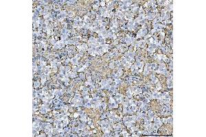 IHC analysis of HLA-DRA using anti-HLA-DRA antibody (ABIN7600948). (HLA-DRA Antikörper  (AA 26-254))