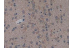 Immunohistochemistry (IHC) image for anti-Natriuretic Peptides B (NPPB) (AA 27-121) antibody (ABIN7445456)