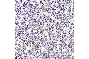 Immunohistochemistry of paraffin-embedded mouse fetal liver using CMIP Rabbit pAb (ABIN7265970) at dilution of 1:50 (40x lens).