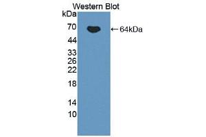 Western blot analysis of the recombinant protein. (IL12B Antikörper  (AA 23-324))