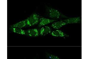 Confocal immunofluorescence analysis of NIH-3T3 cells using ACSS2 Polyclonal Antibody at dilution of 1:200. (ACSS2 Antikörper)